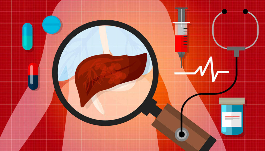 Boldo para la salud hepática y digestiva 5 salud hepatica